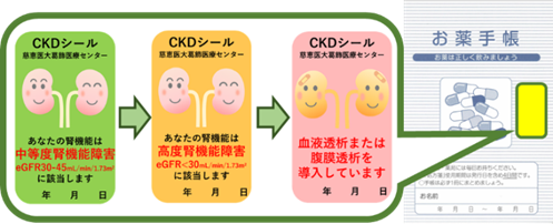 CKD